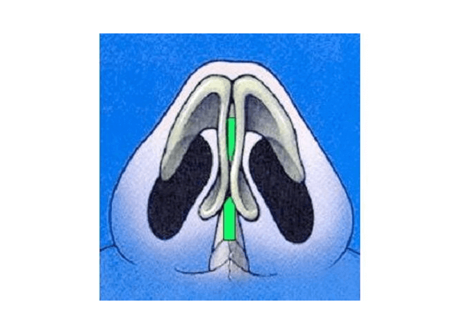 nose tip image